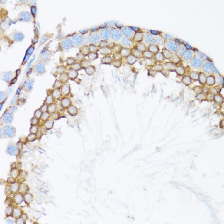 Immunohistochemistry - Anti-CTNNA1 Antibody (A14873) - Antibodies.com