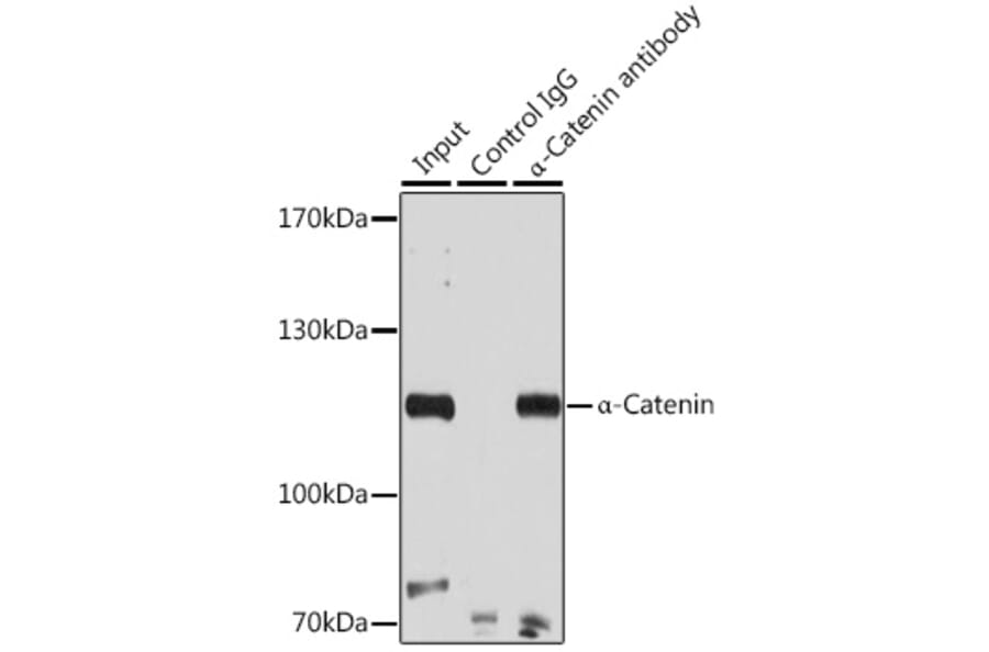 Western Blot - Anti-CTNNA1 Antibody (A14873) - Antibodies.com