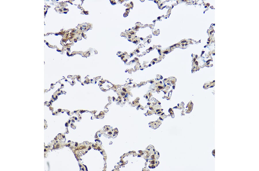 Immunohistochemistry - Anti-DDX3 Antibody (A14874) - Antibodies.com
