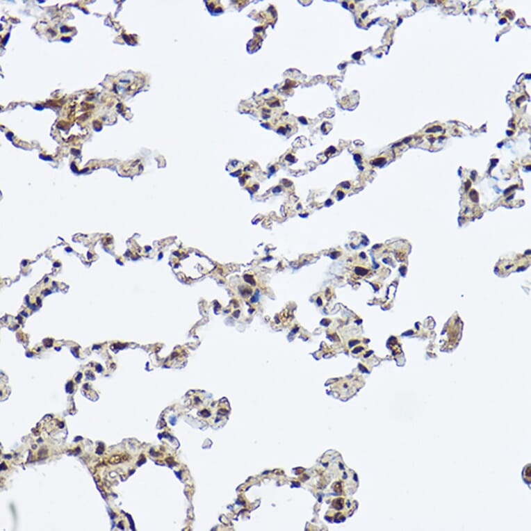Immunohistochemistry - Anti-DDX3 Antibody (A14874) - Antibodies.com