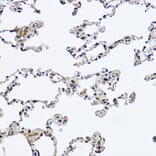 Immunohistochemistry - Anti-DDX3 Antibody (A14874) - Antibodies.com