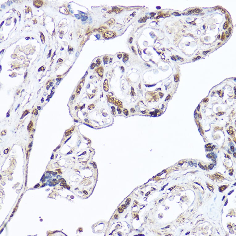 Immunohistochemistry - Anti-DDX3 Antibody (A14874) - Antibodies.com
