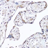 Immunohistochemistry - Anti-DDX3 Antibody (A14874) - Antibodies.com