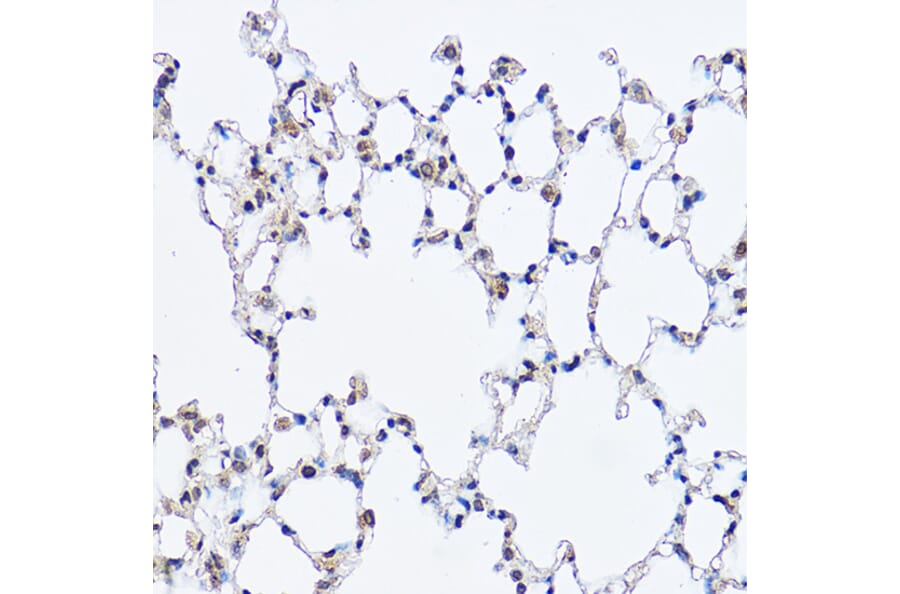 Immunohistochemistry - Anti-DDX3 Antibody (A14874) - Antibodies.com