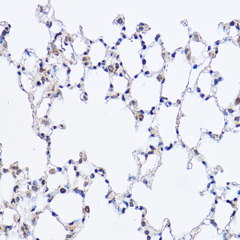 Immunohistochemistry - Anti-DDX3 Antibody (A14874) - Antibodies.com