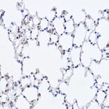 Immunohistochemistry - Anti-DDX3 Antibody (A14874) - Antibodies.com