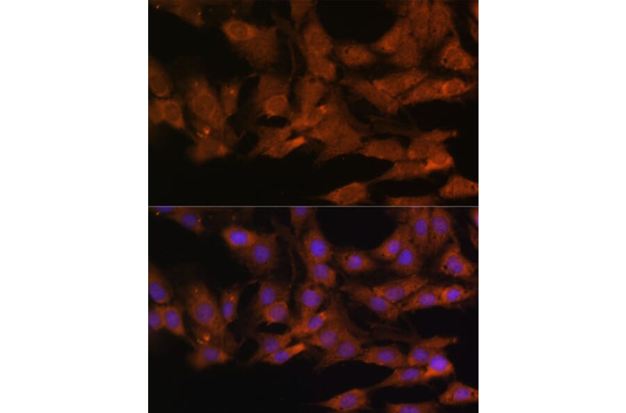 Immunofluorescence - Anti-DDX3 Antibody (A14874) - Antibodies.com