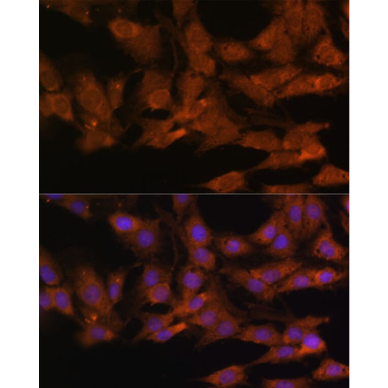 Immunofluorescence - Anti-DDX3 Antibody (A14874) - Antibodies.com