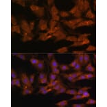 Immunofluorescence - Anti-DDX3 Antibody (A14874) - Antibodies.com