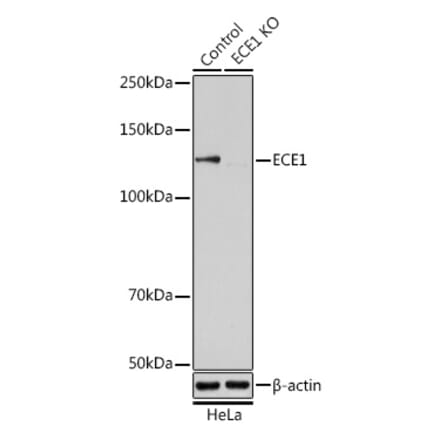 Western Blot - Anti-ECE1 Antibody (A14875) - Antibodies.com