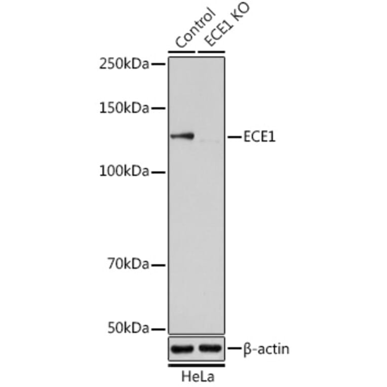 Western Blot - Anti-ECE1 Antibody (A14875) - Antibodies.com
