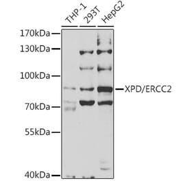 Western Blot - Anti-XPD Antibody (A14876) - Antibodies.com