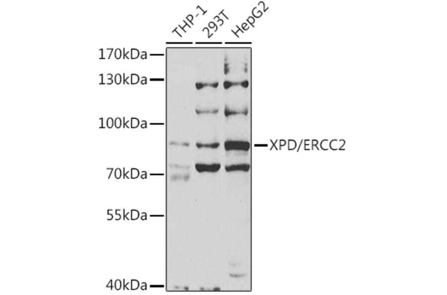 Western Blot - Anti-XPD Antibody (A14876) - Antibodies.com