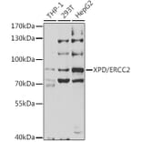 Western Blot - Anti-XPD Antibody (A14876) - Antibodies.com