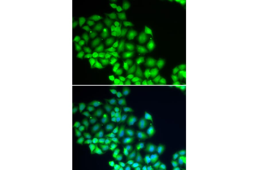 Immunofluorescence - Anti-XPD Antibody (A14876) - Antibodies.com