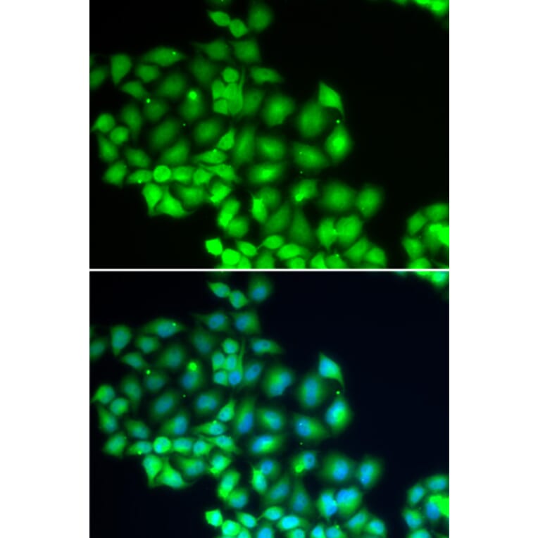 Immunofluorescence - Anti-XPD Antibody (A14876) - Antibodies.com