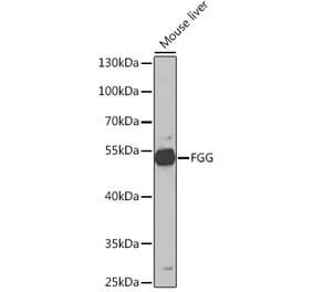 Western Blot - Anti-Fibrinogen gamma chain Antibody (A14877) - Antibodies.com