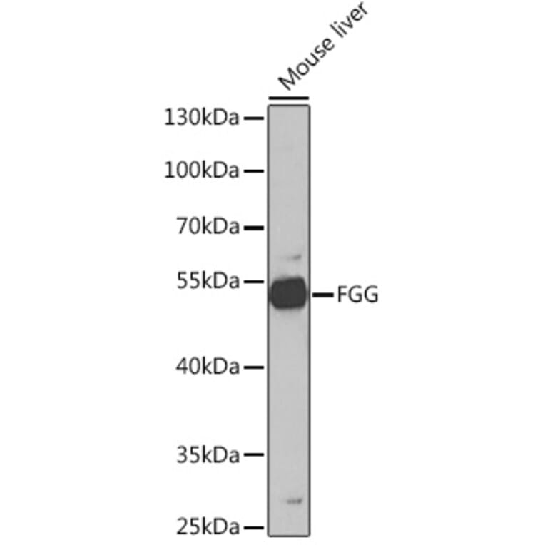 Western Blot - Anti-Fibrinogen gamma chain Antibody (A14877) - Antibodies.com