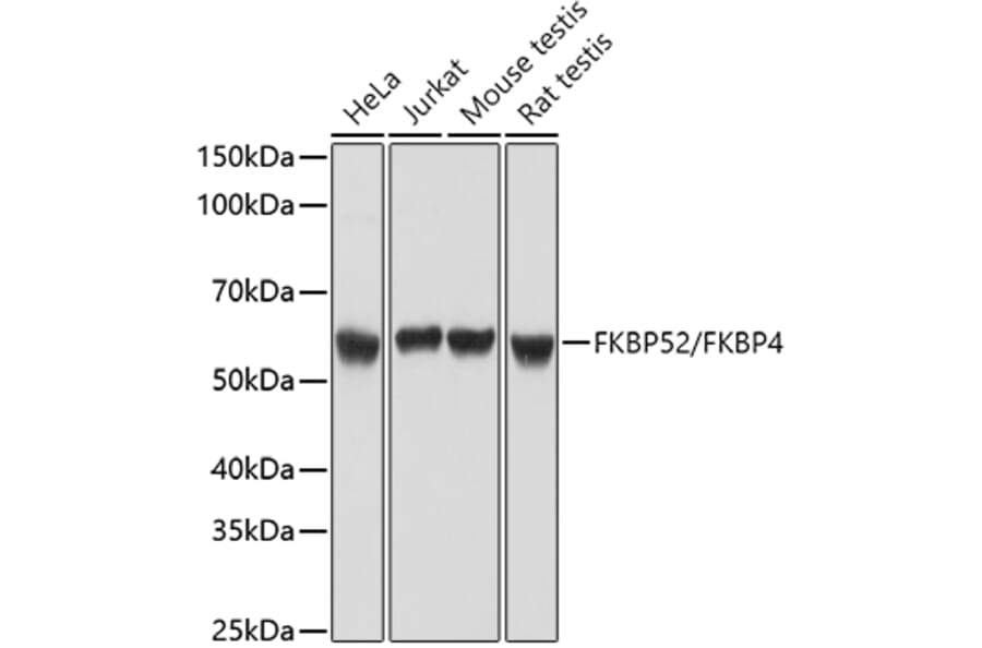 Western Blot - Anti-FKBP52 Antibody (A14878) - Antibodies.com