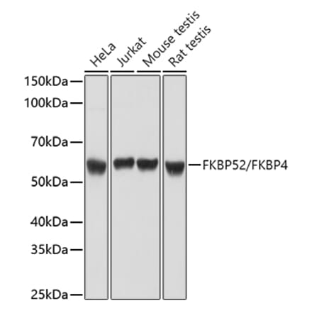 Western Blot - Anti-FKBP52 Antibody (A14878) - Antibodies.com