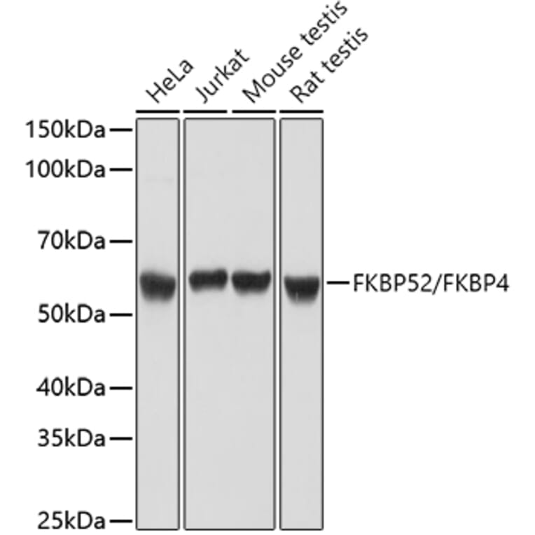 Western Blot - Anti-FKBP52 Antibody (A14878) - Antibodies.com