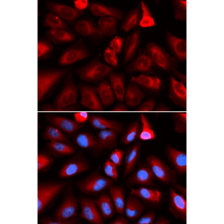 Immunofluorescence - Anti-FKBP52 Antibody (A14878) - Antibodies.com