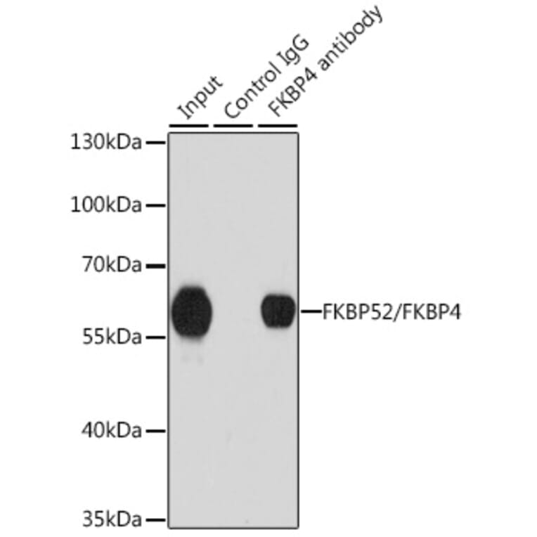 Western Blot - Anti-FKBP52 Antibody (A14878) - Antibodies.com