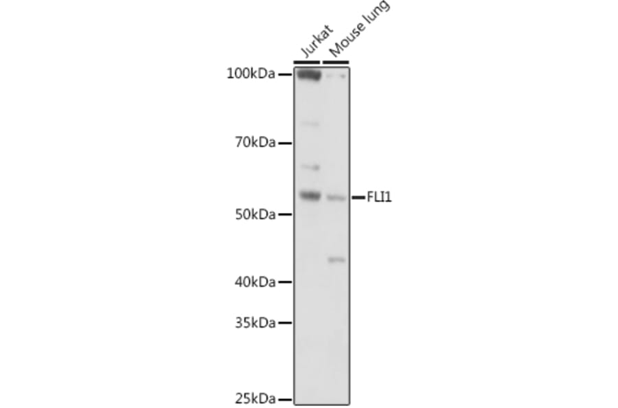 Western Blot - Anti-FLI1 Antibody (A14879) - Antibodies.com