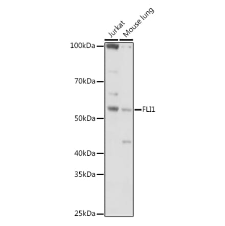Western Blot - Anti-FLI1 Antibody (A14879) - Antibodies.com