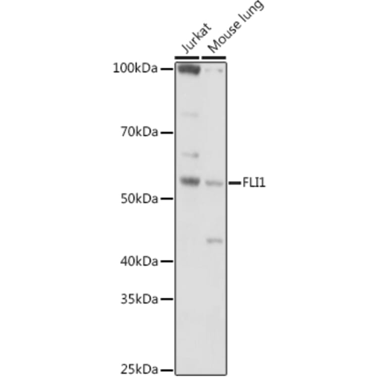 Western Blot - Anti-FLI1 Antibody (A14879) - Antibodies.com