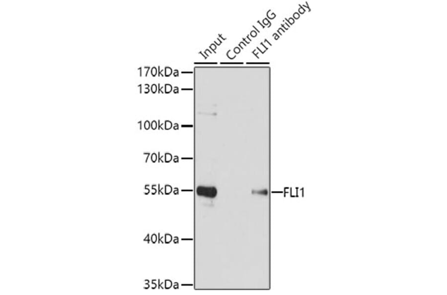 Western Blot - Anti-FLI1 Antibody (A14879) - Antibodies.com