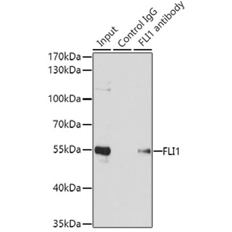 Western Blot - Anti-FLI1 Antibody (A14879) - Antibodies.com