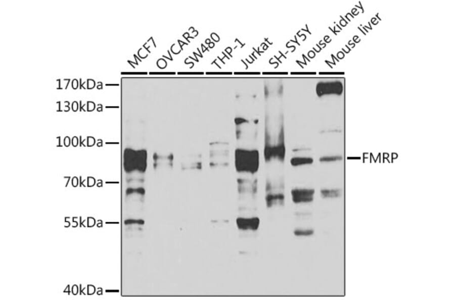 Western Blot - Anti-FMRP Antibody (A14880) - Antibodies.com