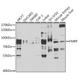 Western Blot - Anti-FMRP Antibody (A14880) - Antibodies.com