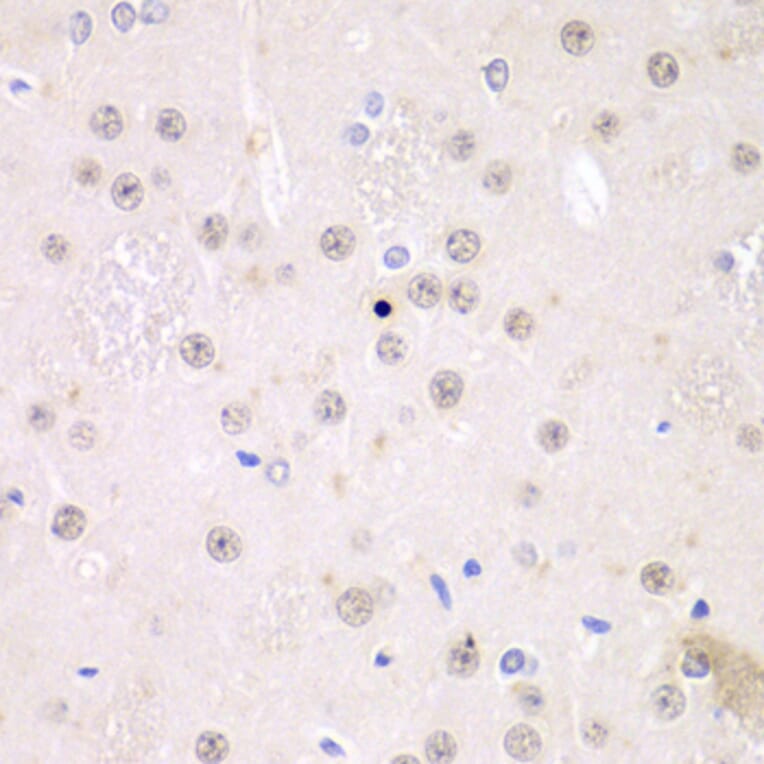 Immunohistochemistry - Anti-FMRP Antibody (A14880) - Antibodies.com