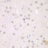 Immunohistochemistry - Anti-FMRP Antibody (A14880) - Antibodies.com