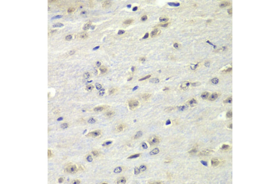 Immunohistochemistry - Anti-FMRP Antibody (A14880) - Antibodies.com