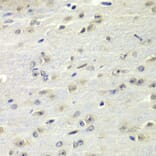 Immunohistochemistry - Anti-FMRP Antibody (A14880) - Antibodies.com
