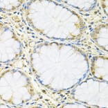 Immunohistochemistry - Anti-FMRP Antibody (A14880) - Antibodies.com