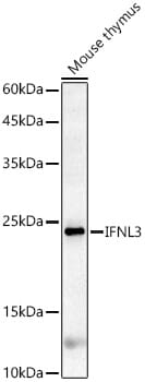 Western blot analysis of extracts of mouse liver, using Anti-IFNL3 Antibody (A5648) at 1:1,000 dilution.
Secondary antibody: Goat Anti-Rabbit IgG (H+L) (HRP) (AS014) at 1:10,000 dilution.
Lysates / proteins: 25µg per lane.
Blocking buffer: 3% non-fat dry milk in TBST.
Detection: ECL Enhanced Kit (RM00021).
Exposure time: 90s.