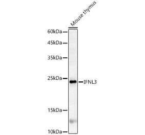Western Blot - Anti-IL-28B Antibody (A14881) - Antibodies.com