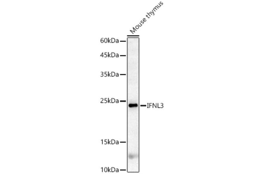 Western Blot - Anti-IL-28B Antibody (A14881) - Antibodies.com