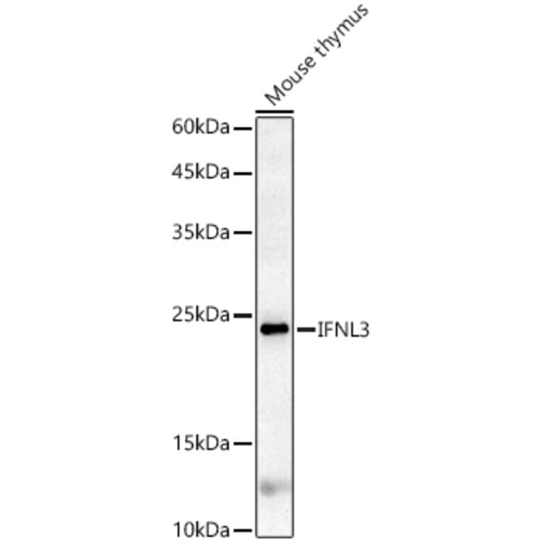 Western Blot - Anti-IL-28B Antibody (A14881) - Antibodies.com