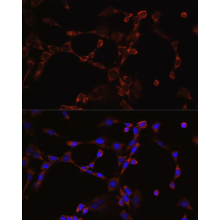 Immunofluorescence - Anti-NLRP3 Antibody (A5652) - Antibodies.com