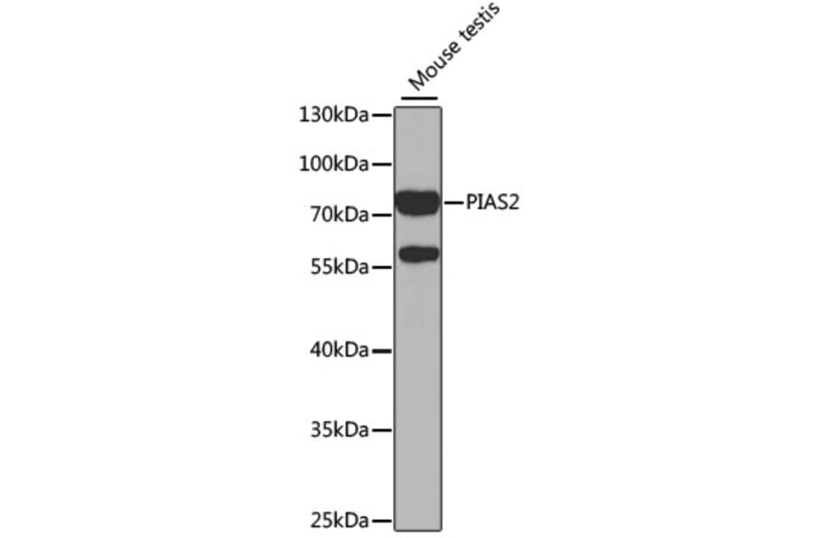 Western Blot - Anti-PIAS2 Antibody (A14883) - Antibodies.com
