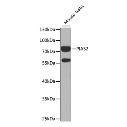 Western Blot - Anti-PIAS2 Antibody (A14883) - Antibodies.com
