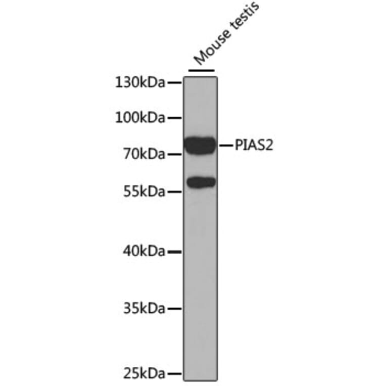 Western Blot - Anti-PIAS2 Antibody (A14883) - Antibodies.com