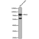 Western Blot - Anti-PIAS2 Antibody (A14883) - Antibodies.com