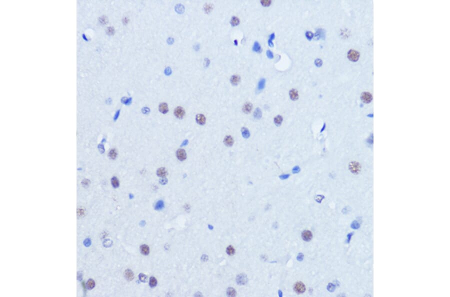 Immunohistochemistry - Anti-PIAS2 Antibody (A14883) - Antibodies.com