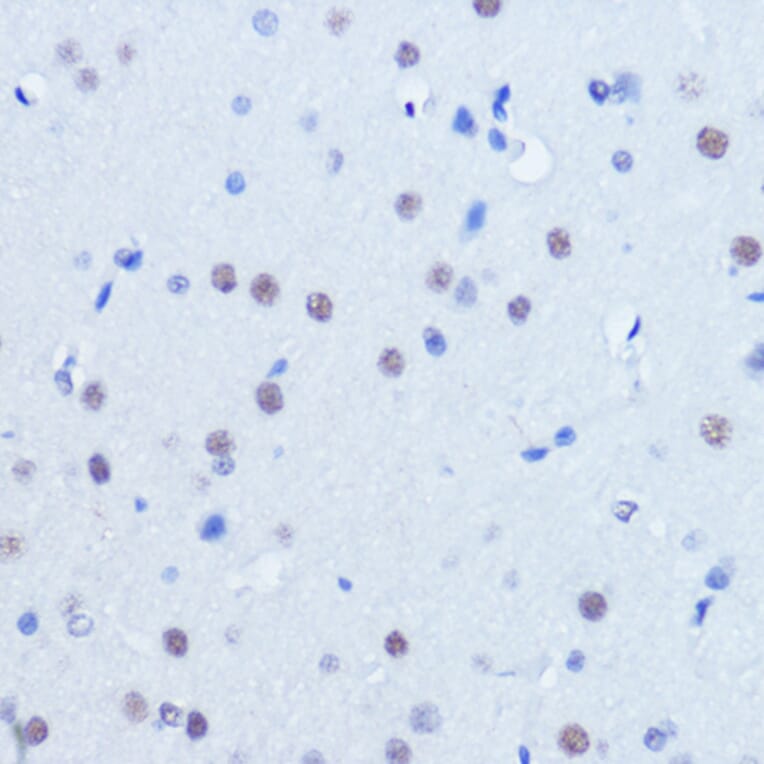 Immunohistochemistry - Anti-PIAS2 Antibody (A14883) - Antibodies.com